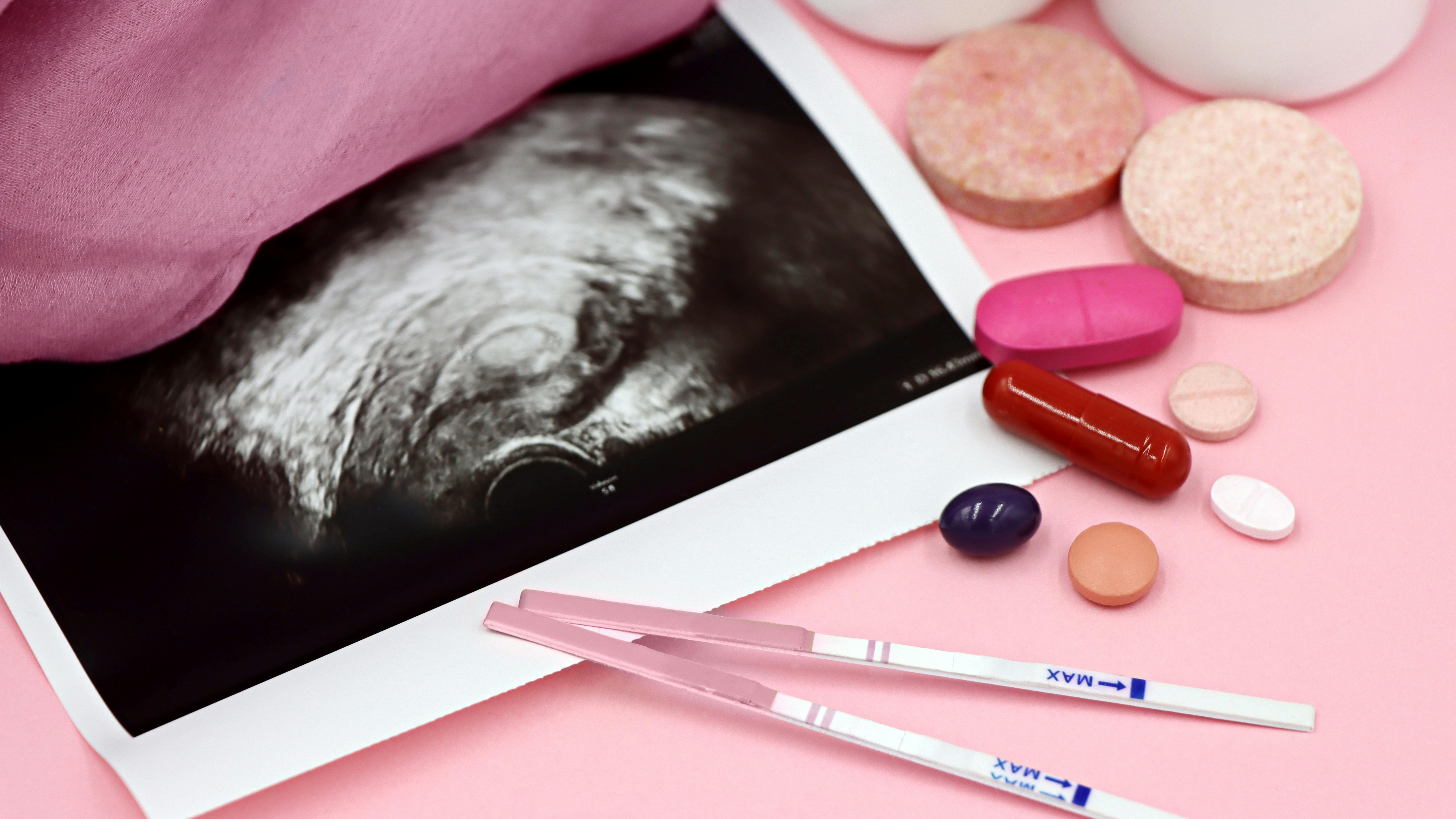 Ultrasound photo, ovulation test strips, and fertility medications on a pink background